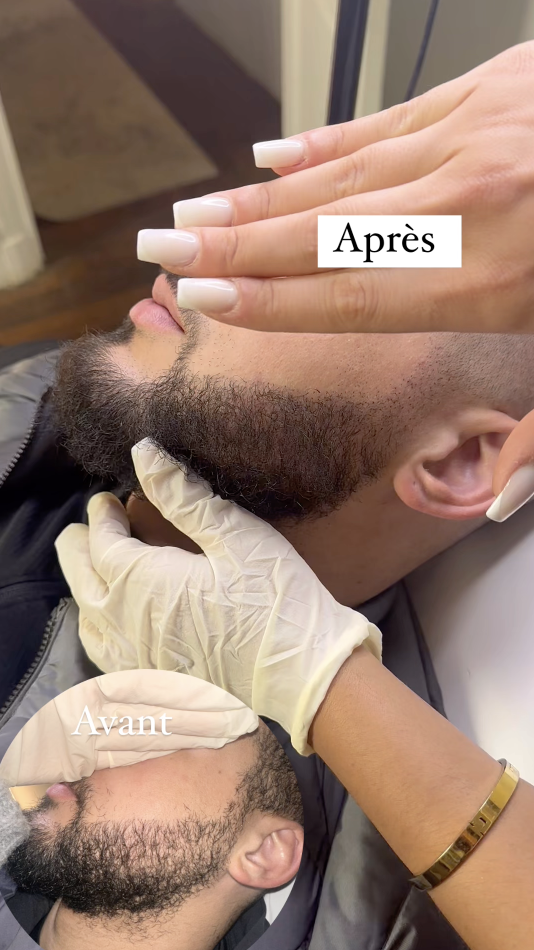Résultat barbe
