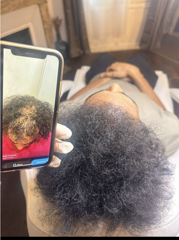 Repousse des golfes cheveux homme