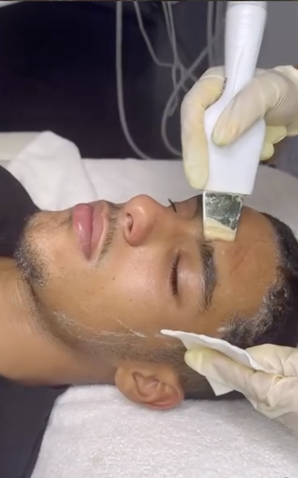 Aspiration hydrofacial