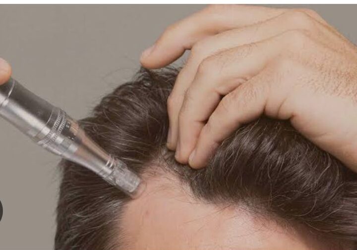 Mésothérapie injection